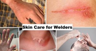 Skin Care for Welders